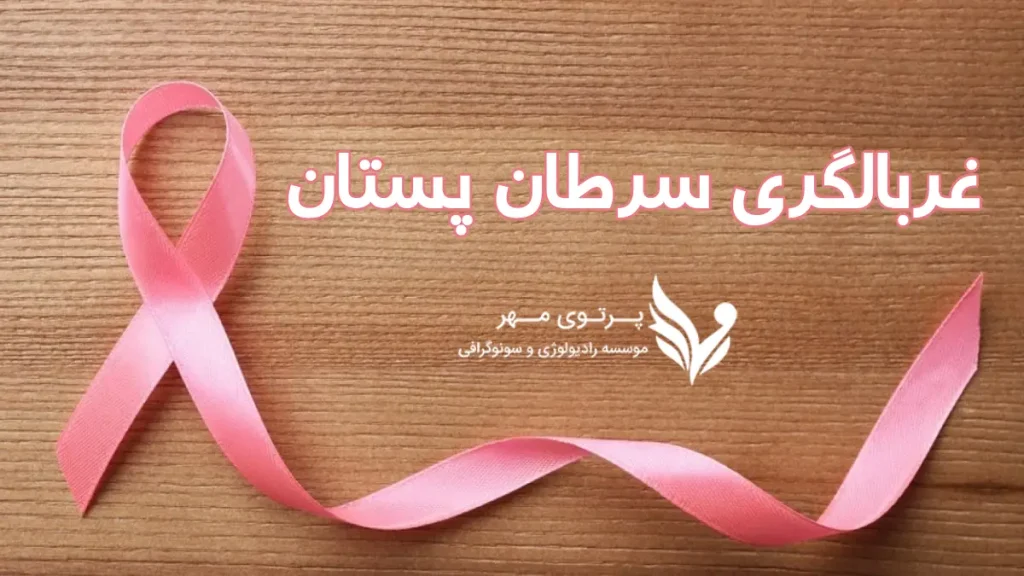 غربالگری سرطان پستان