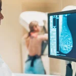 ماموگرافی چیست