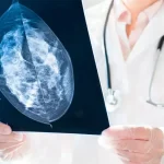 تفاوت توموسنتز با ماموگرافی