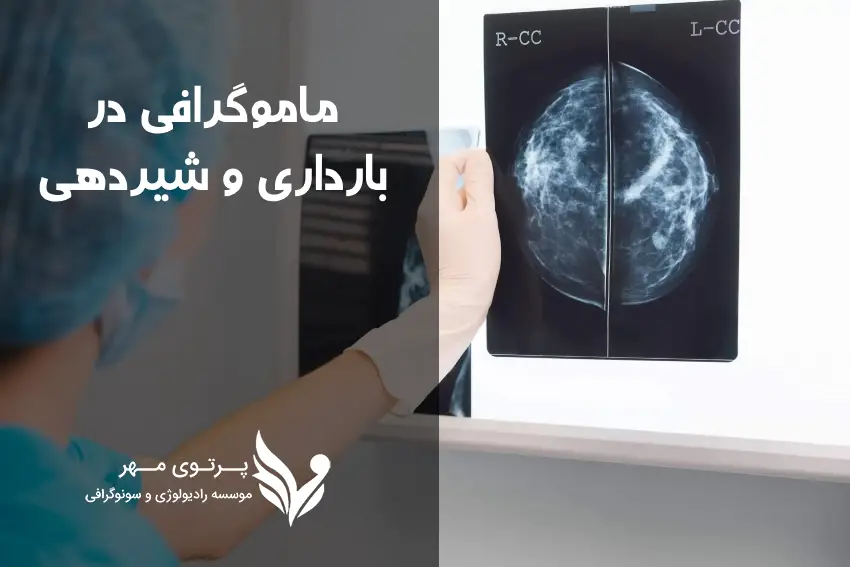 ماموگرافی در شیردهی