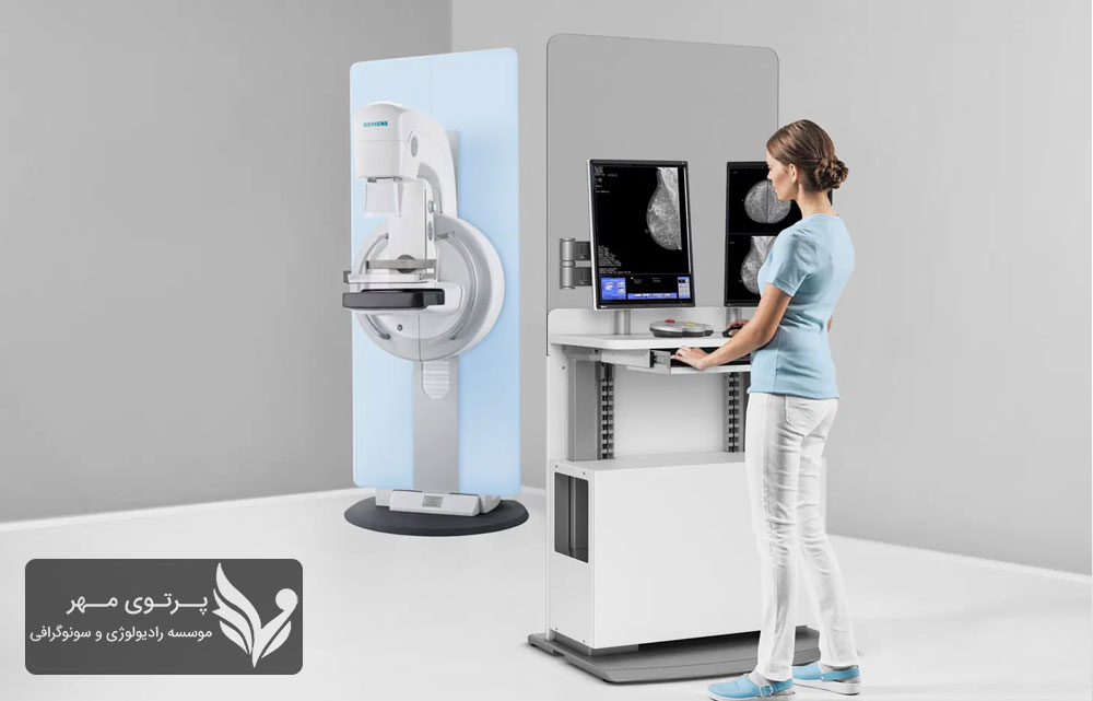 از چه سنی باید ماموگرافی انجام داد؟