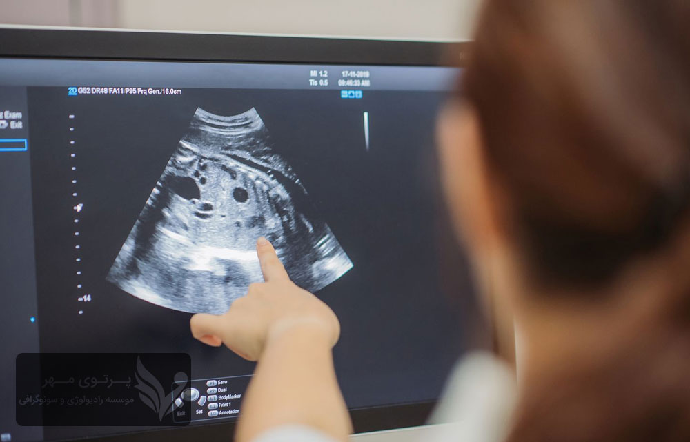 آیا سونوگرافی بارداری برای جنین خطرناک است؟بررسی علمی مزایا و عوارض