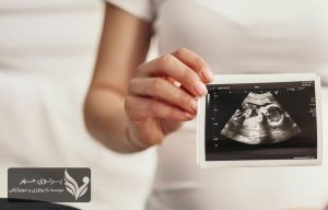 تفسیر نتیجه سونوگرافی بارداری به زبان ساده: راهنمای کامل برای درک تصاویر سونوگرافی آیا سونوگرافی بارداری برای جنین خطرناک است؟بررسی علمی مزایا و عوارض