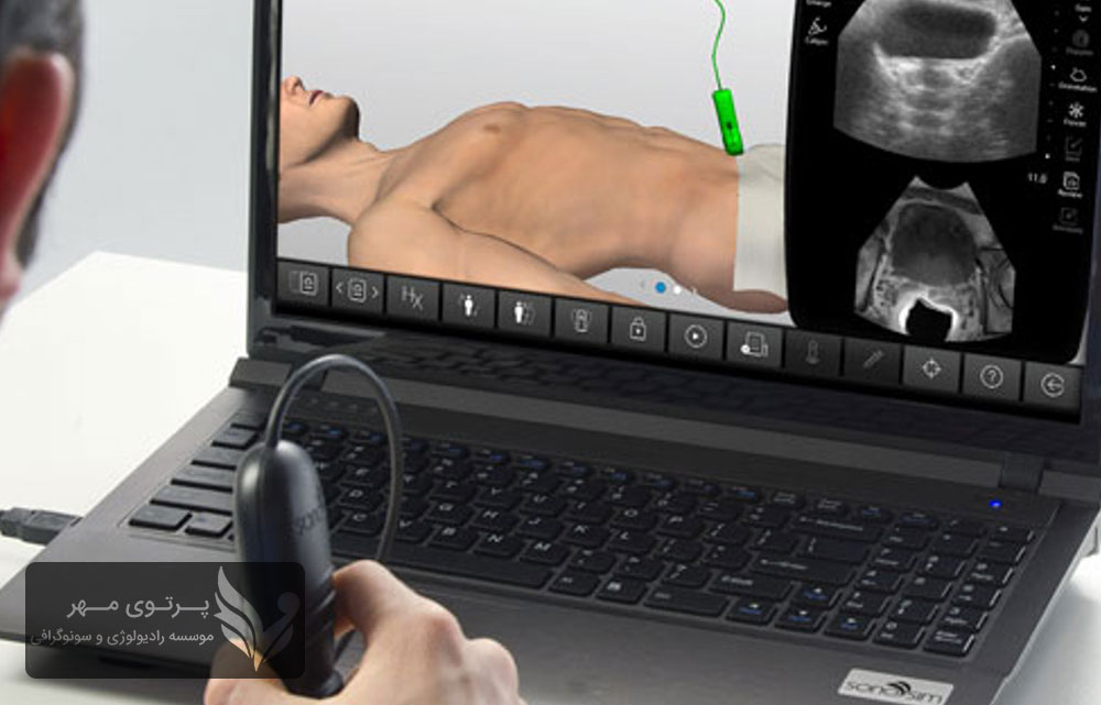 عوارض احتمالی سونوگرافی پروستات