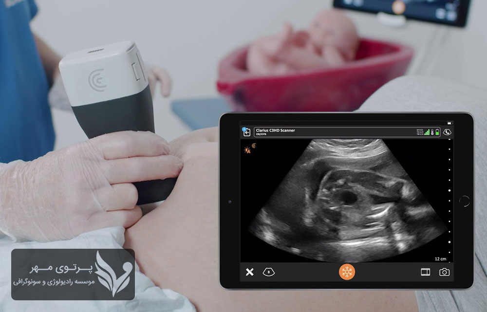 پکیج سلامت جامع رادیولوژی آقایان