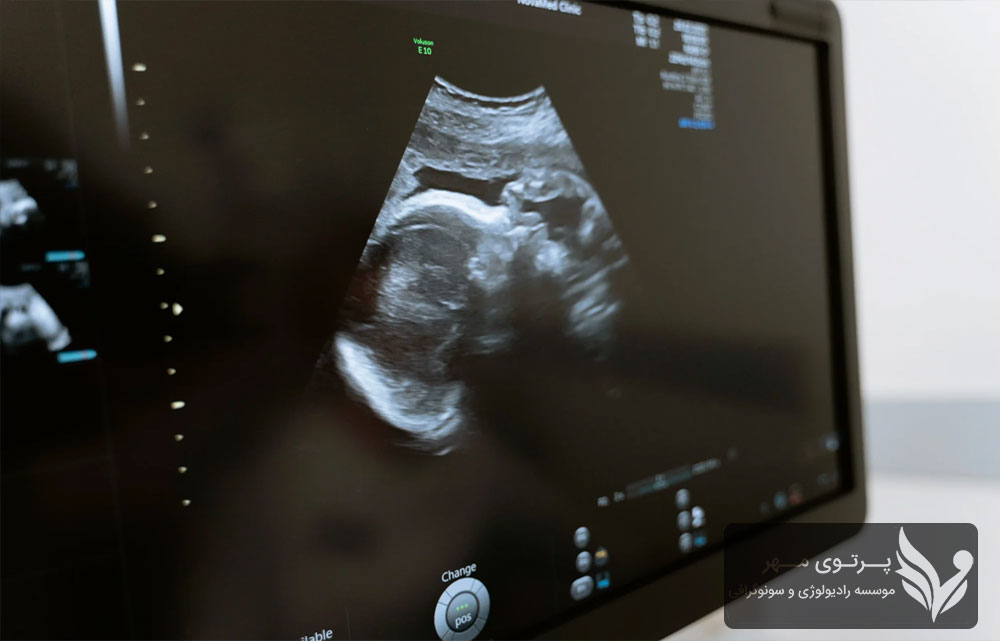 پکیج سلامت جامع رادیولوژی آقایان