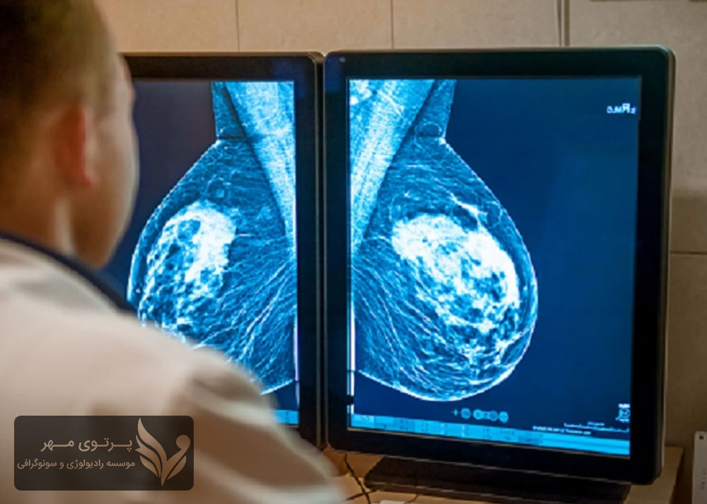 سونوگرافی سینه چیست؟