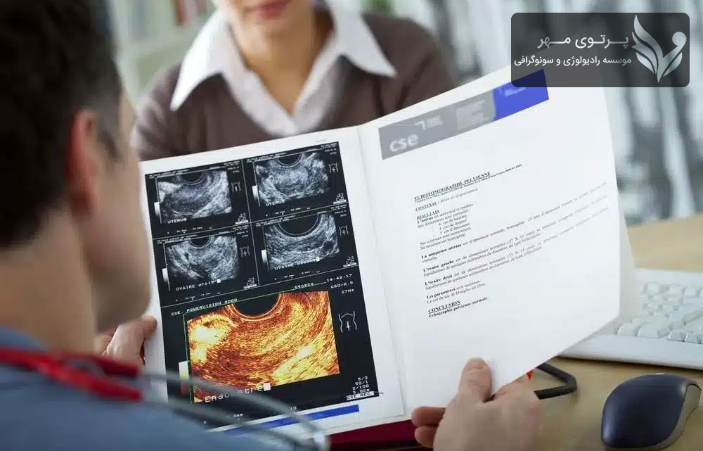 سونوگرافی رحم و تخمدان: بررسی سلامت رحم و تخمدان‌ها