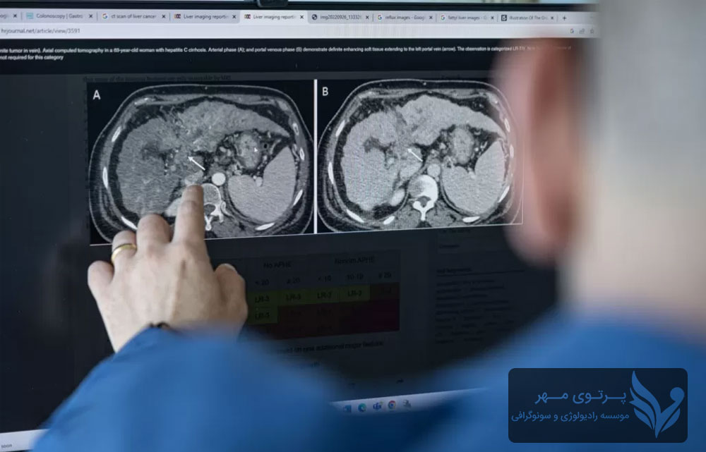 سونوگرافی کبد و کلیه: سلامت کبد و کلیه‌ها را جدی بگیرید