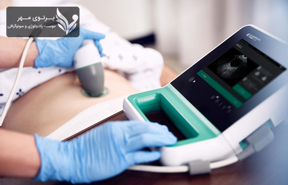 گزارش سونوگرافی مثانه: بررسی مشکلات ادراری و مثانه