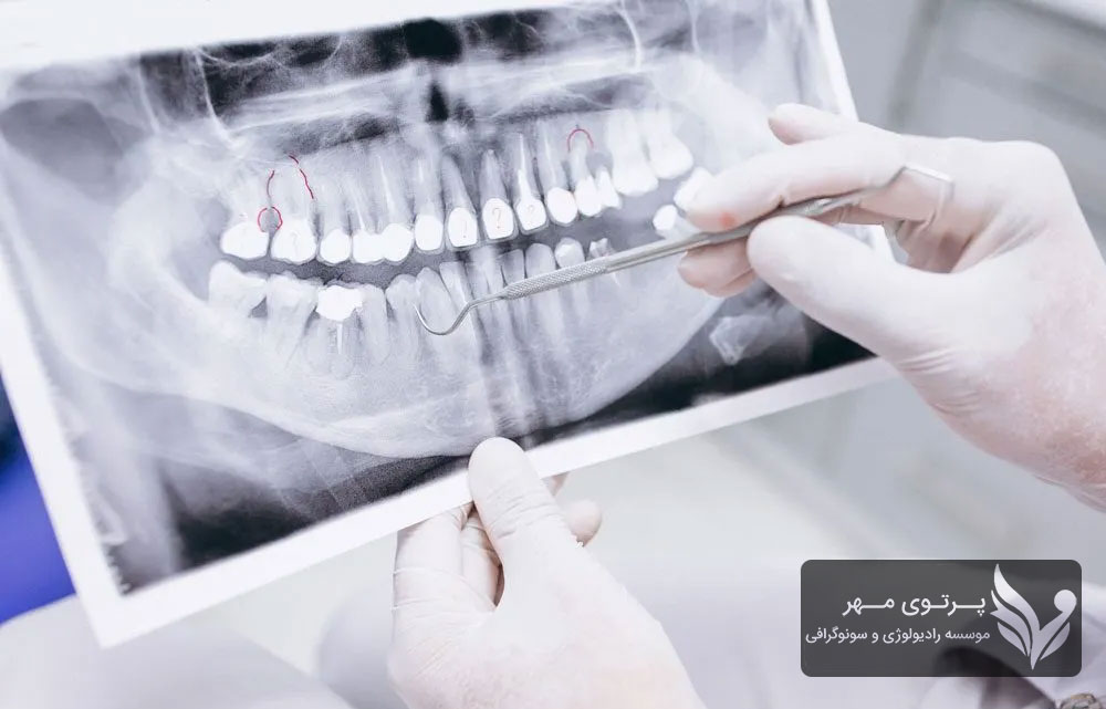 رادیولوژی دندان و اهمیت سفالومتری برای ارتودنسی: چرا این تکنیک ضروری است؟