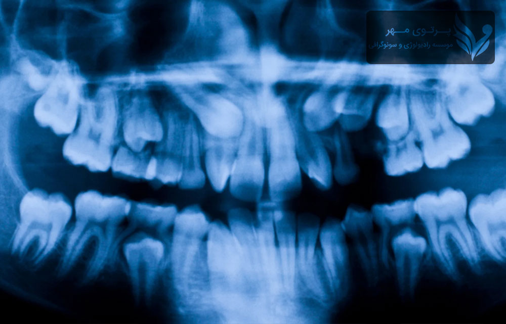 سفالومتری چیست؟