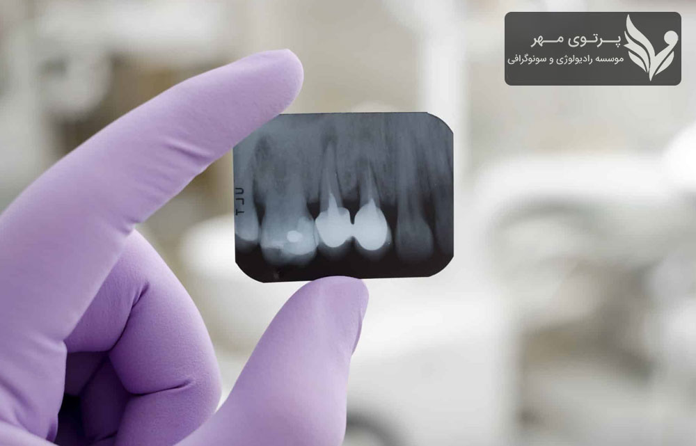 آیا سفالومتری برای همه بیماران ارتودنسی الزامی است؟