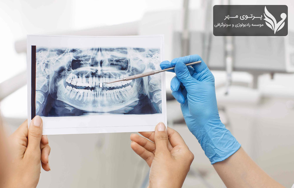 سخن پایانی درباره رادیولوژی دندان و اهمیت سفالومتری برای ارتودنسی
