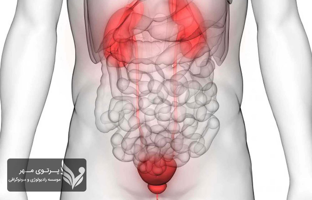 انواع روش‌های تصویربرداری اورولوژیک