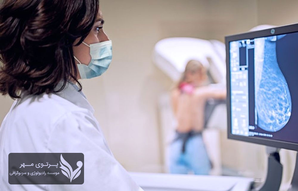 ماموگرافی یا سونوگرافی؛ کدام بهتر است؟