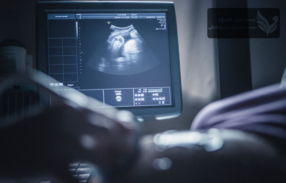 غربالگری سه ماهه اول بارداری