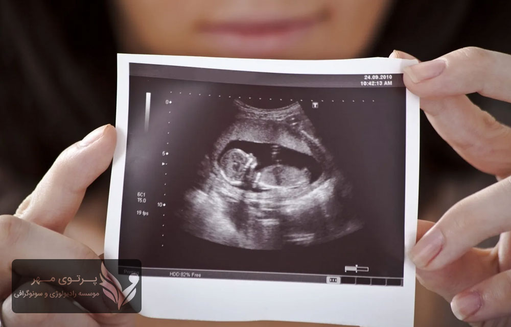 آیا انجام هر دو غربالگری ضروری است؟