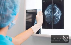 توموسنتز: انقلاب ماموگرافی سه‌بعدی در تشخیص زودهنگام سرطان سینه