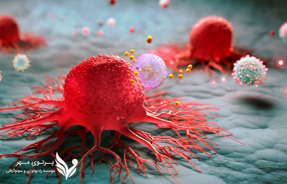 ارتباط گروه خونی و علائم سرطان 
