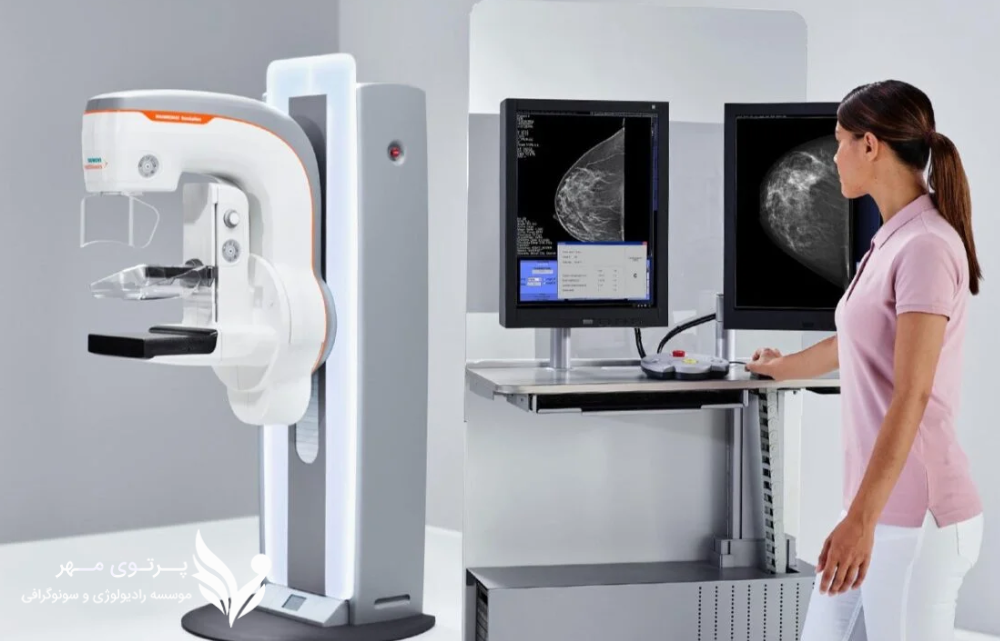 توموسنتز سه بعدی